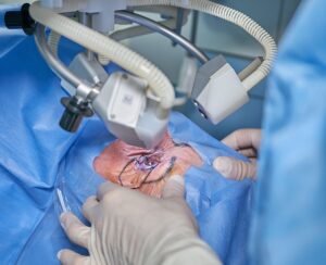 best cataract surgeon in Jalandhar