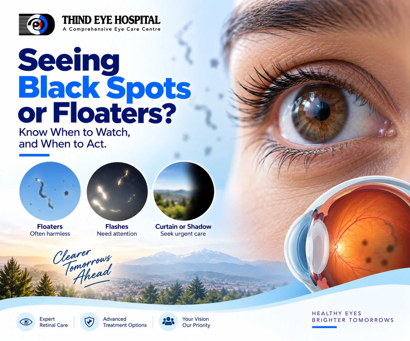 Black Spots and Floaters in Your Eyes: Harmless or Not?